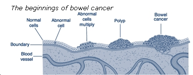 bowel