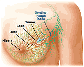 breast lymph nodes