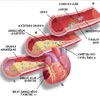 cholesterol