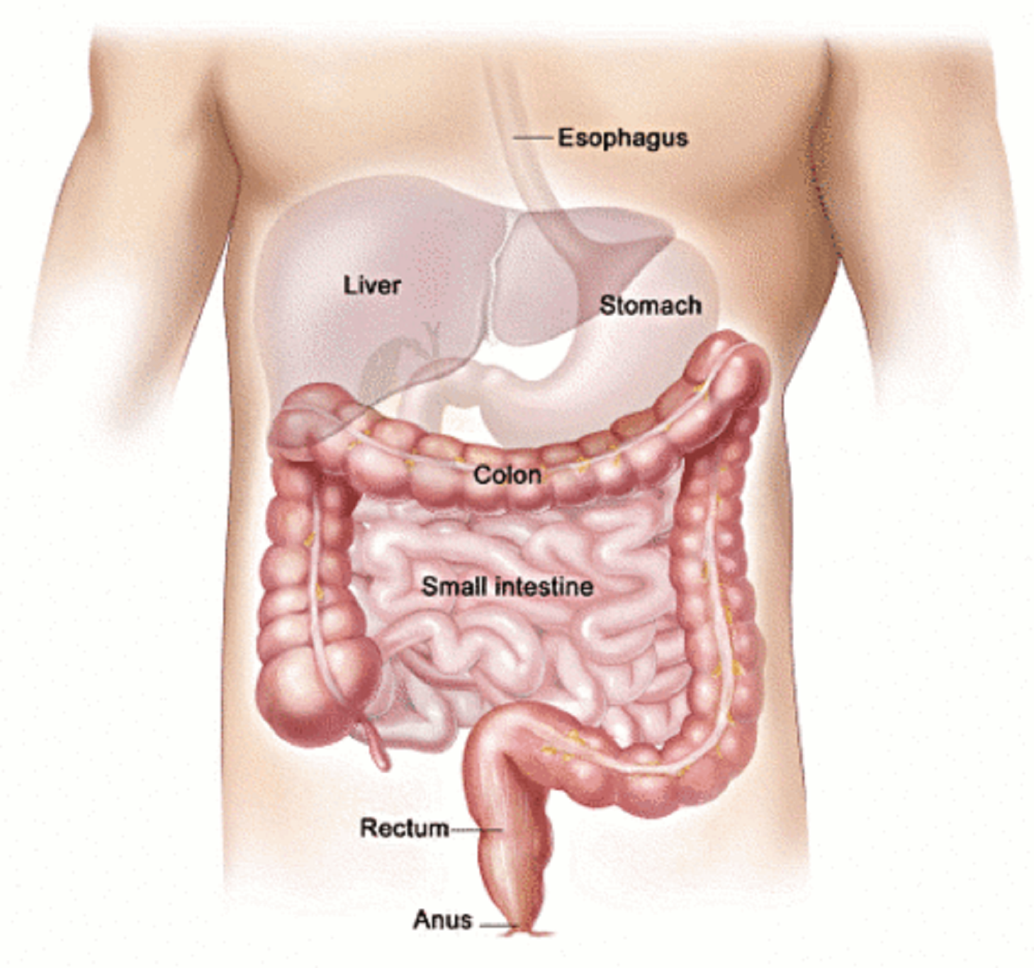 hiatus hernia digestive system gut